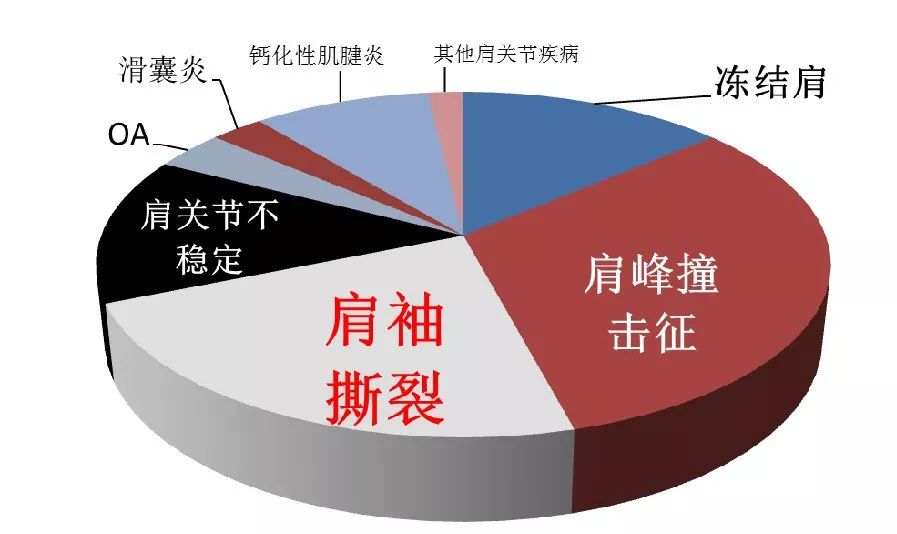 被忽略的肩痛：肱二头肌长头腱，你Get了吗？