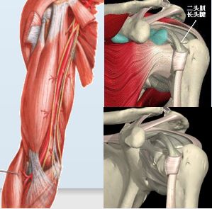 被忽略的肩痛：肱二头肌长头腱，你Get了吗？
