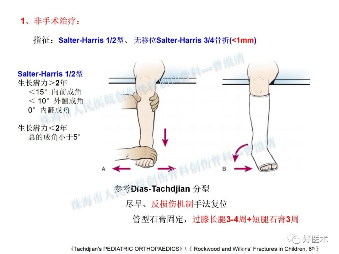 纯高清图谱讲解儿童踝关节骨折，99%的人都能看懂！