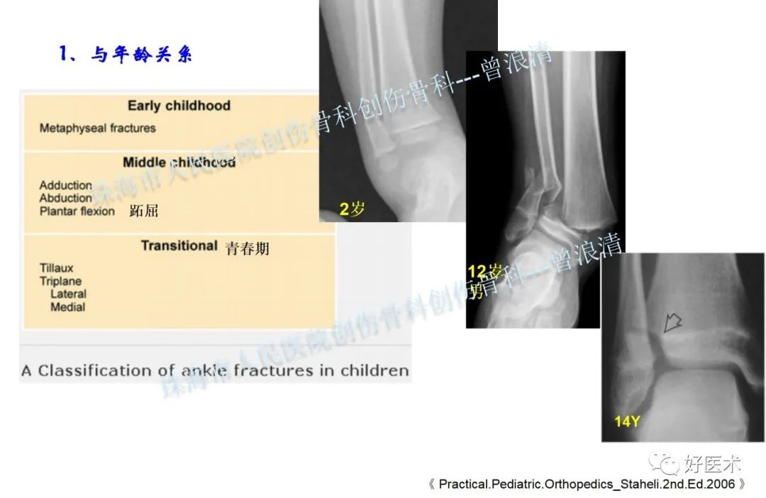 纯高清图谱讲解儿童踝关节骨折，99%的人都能看懂！
