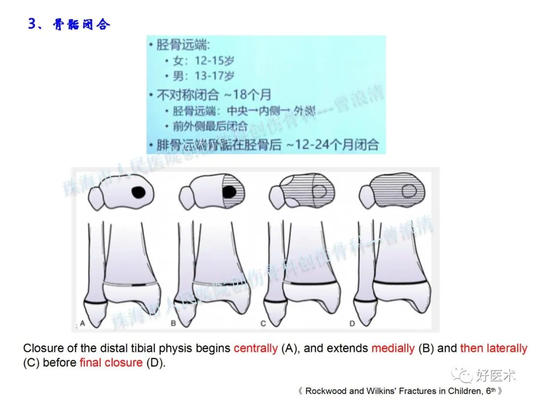 纯高清图谱讲解儿童踝关节骨折，99%的人都能看懂！