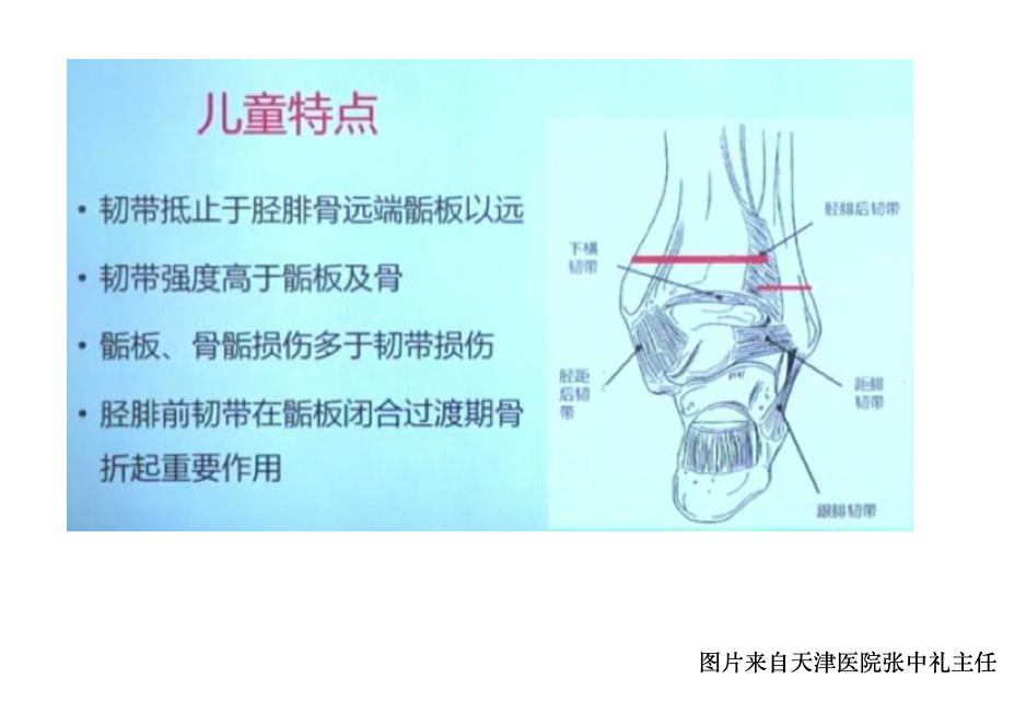 纯高清图谱讲解儿童踝关节骨折，99%的人都能看懂！