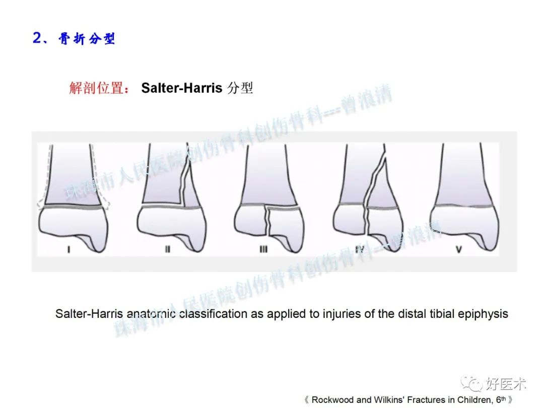 纯高清图谱讲解儿童踝关节骨折，99%的人都能看懂！