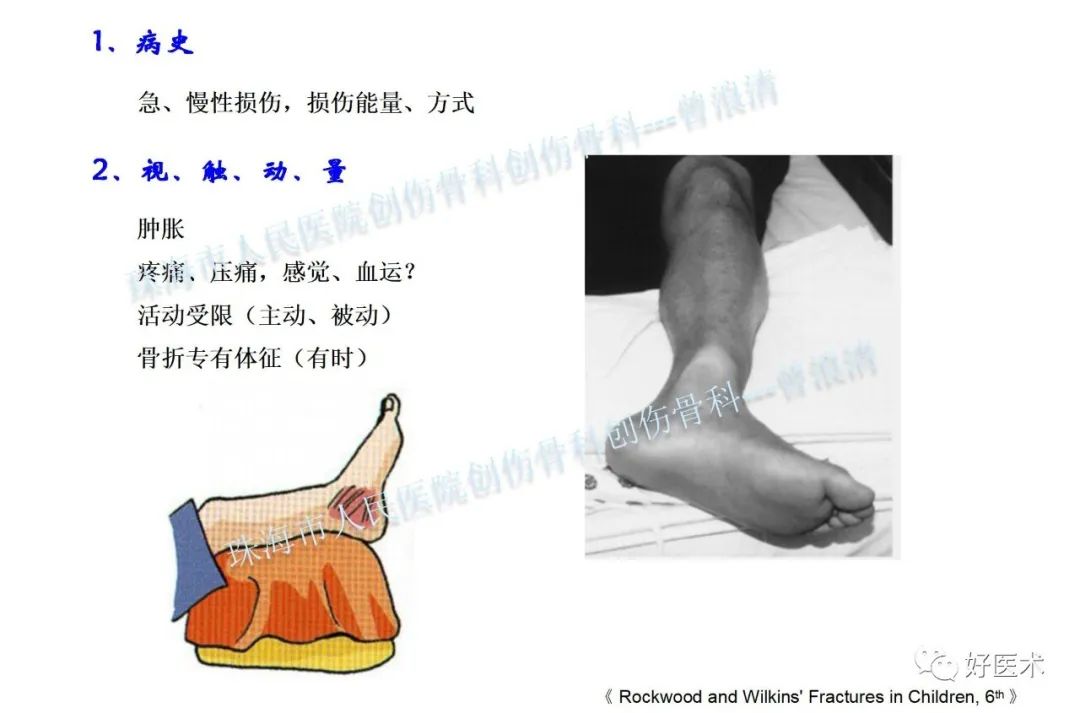 纯高清图谱讲解儿童踝关节骨折，99%的人都能看懂！