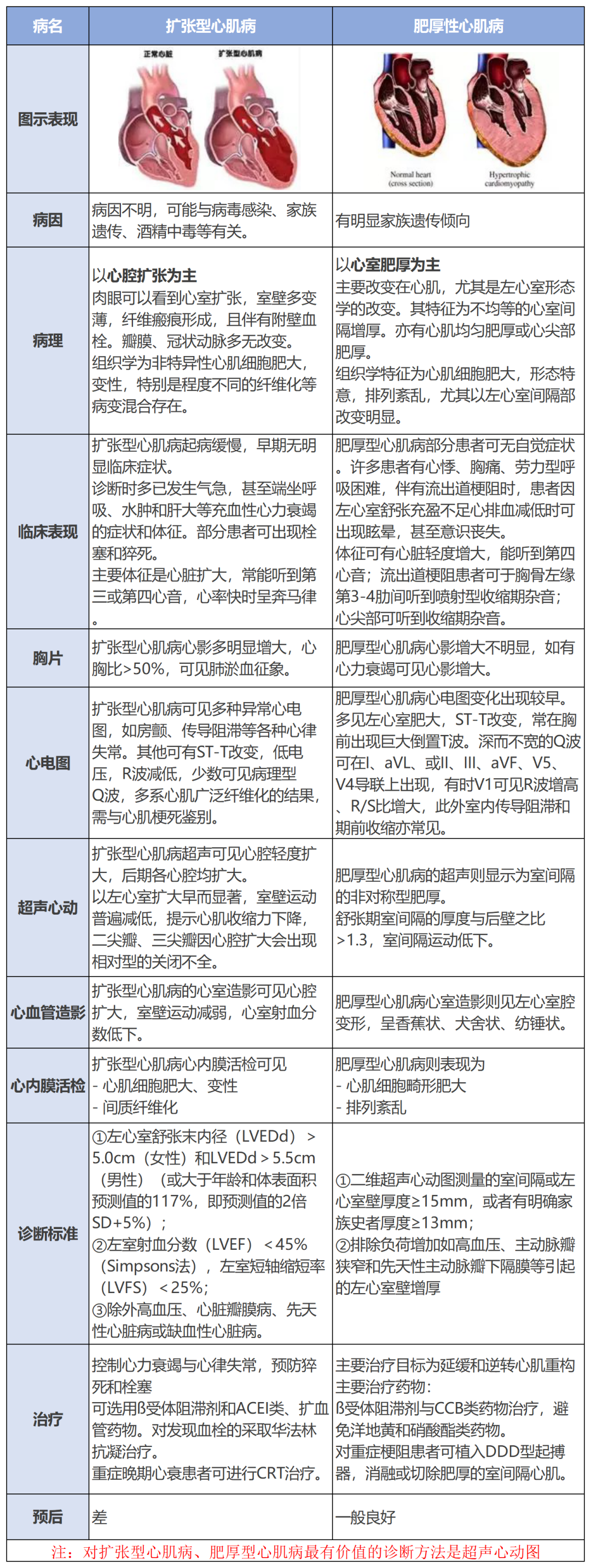 扩张型心肌病