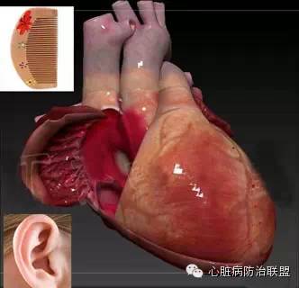 高清珍藏版！心脏解剖3D图谱~