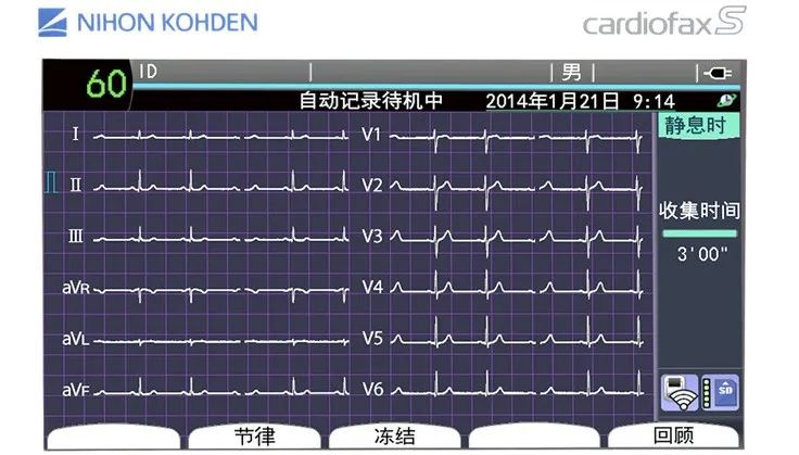 心电图分析三步曲（粗读、细读、结合临床诊断）