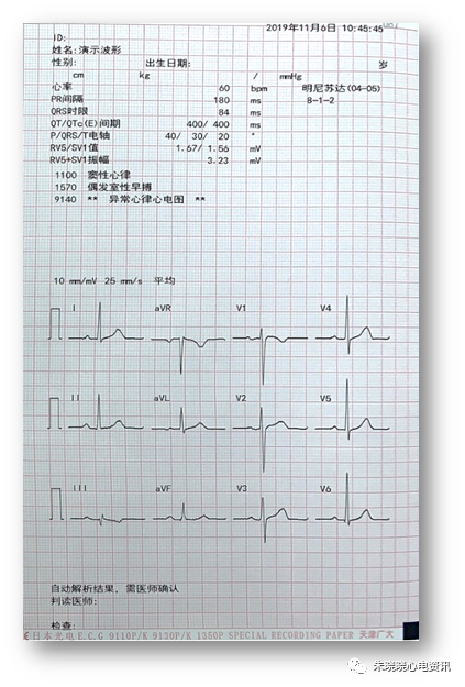 心电图分析三步曲（粗读、细读、结合临床诊断）