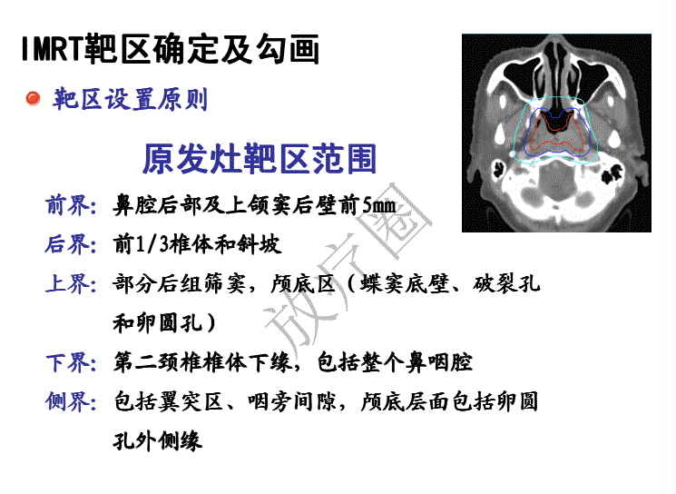 鼻咽癌调强放疗靶区勾画原则