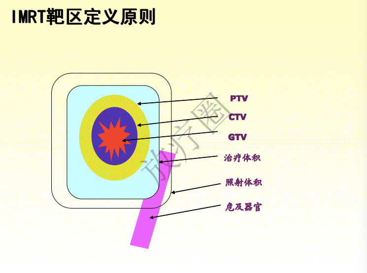 鼻咽癌调强放疗靶区勾画原则