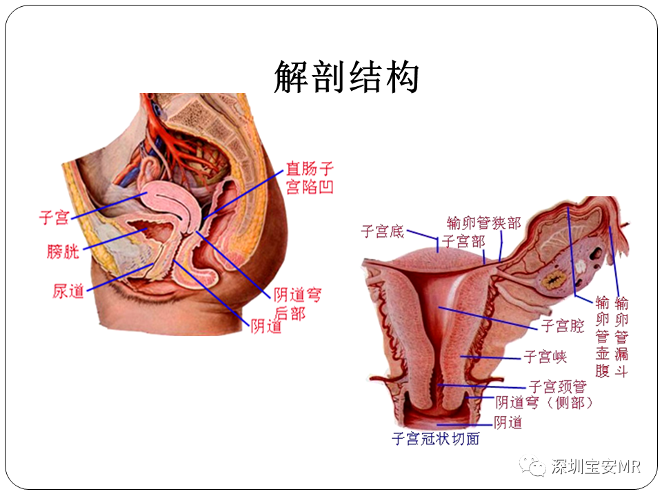 子宫内膜癌MRI诊断及鉴别诊断