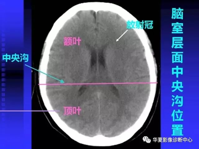 入门必修课：头颅MRI读片详解