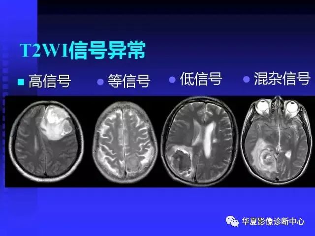 入门必修课：头颅MRI读片详解