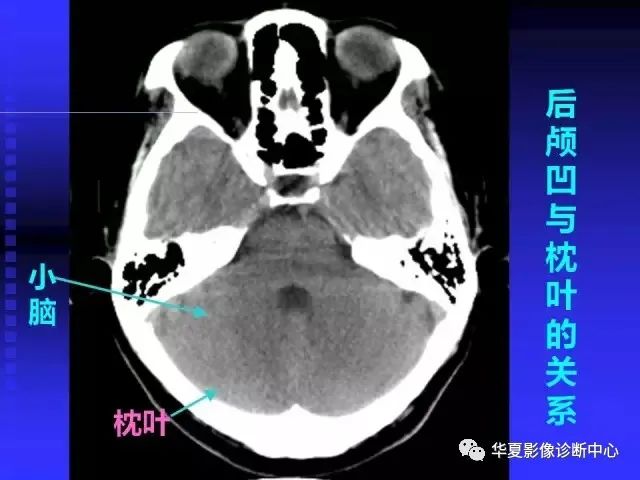 入门必修课：头颅MRI读片详解