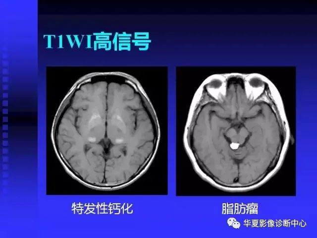 入门必修课：头颅MRI读片详解