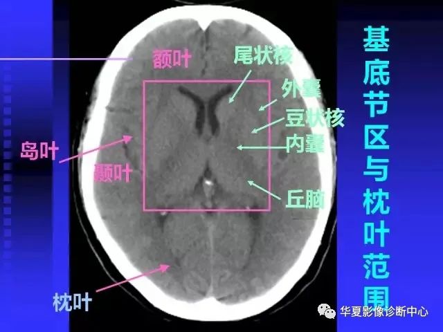 入门必修课：头颅MRI读片详解