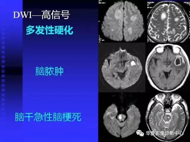 入门必修课：头颅MRI读片详解