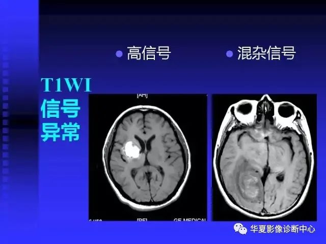 入门必修课：头颅MRI读片详解