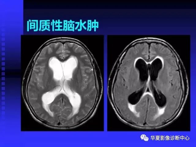 入门必修课：头颅MRI读片详解