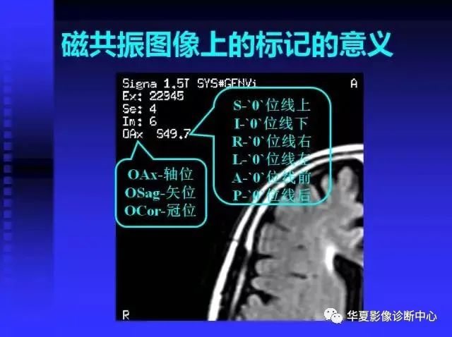 入门必修课：头颅MRI读片详解