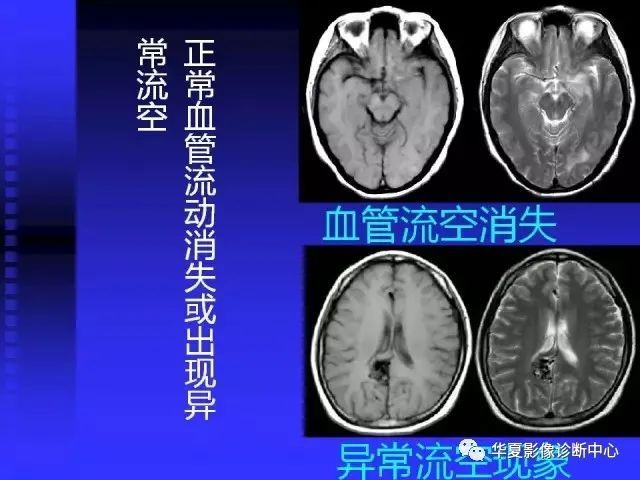 入门必修课：头颅MRI读片详解