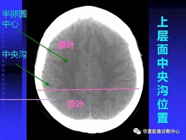 入门必修课：头颅MRI读片详解