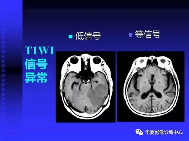 入门必修课：头颅MRI读片详解