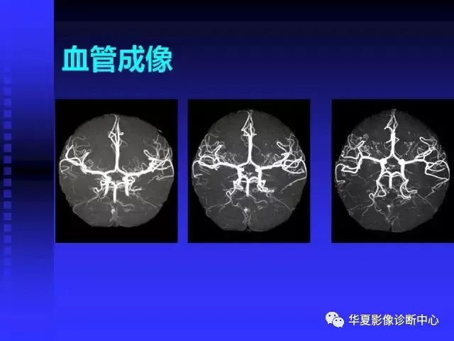 入门必修课：头颅MRI读片详解