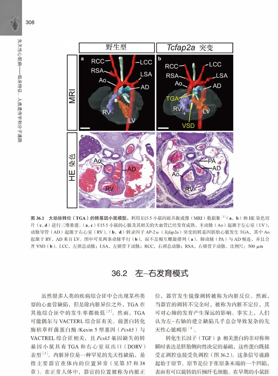 胡盛寿院士主审新书，三步学习先天性心脏病的诊断以及治疗