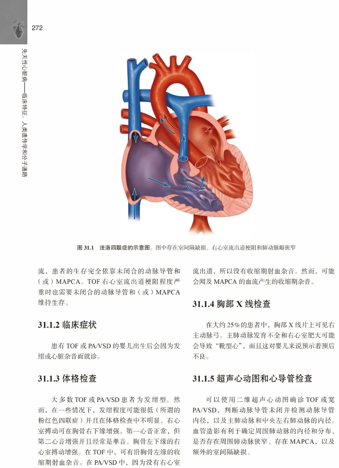 胡盛寿院士主审新书，三步学习先天性心脏病的诊断以及治疗