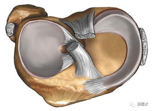 80张珍藏版超清动图，全面掌握半月板损伤MRI诊断！
