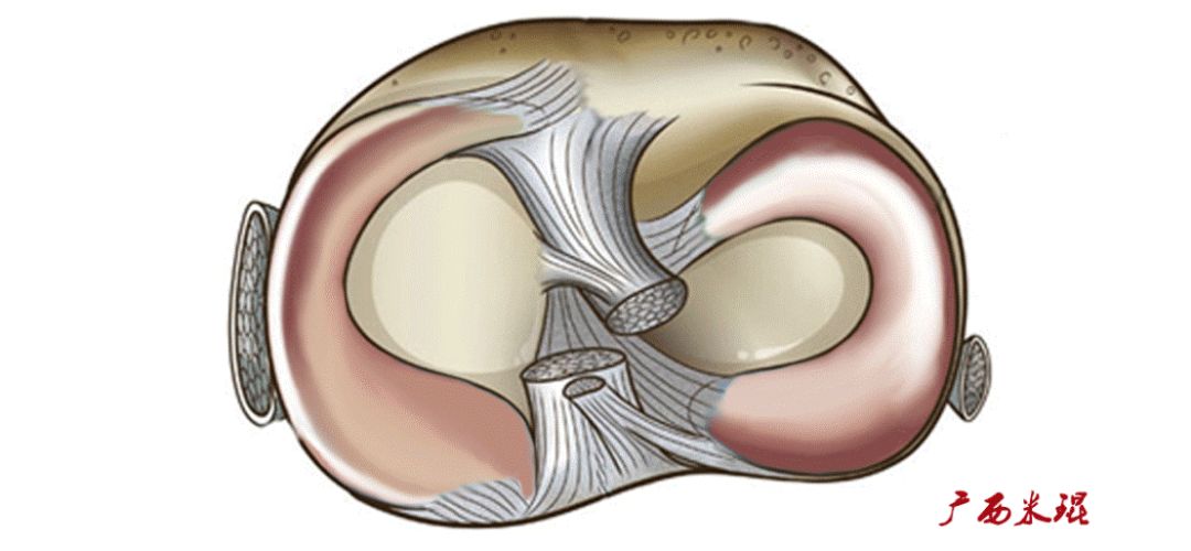 80张珍藏版超清动图，全面掌握半月板损伤MRI诊断！