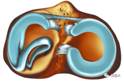 80张珍藏版超清动图，全面掌握半月板损伤MRI诊断！