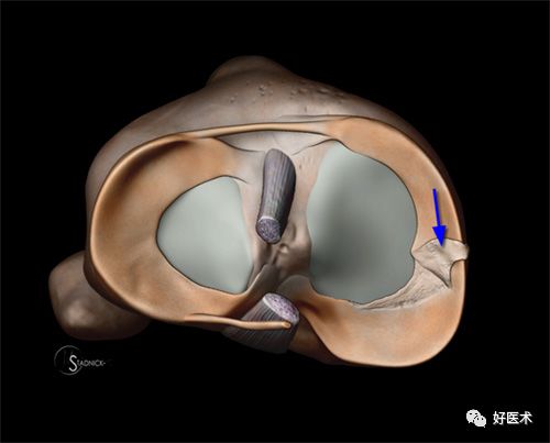 80张珍藏版超清动图，全面掌握半月板损伤MRI诊断！