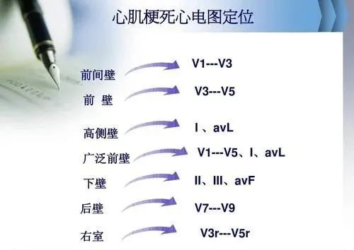 全面解读心电图报告，不再懵懵懂懂！