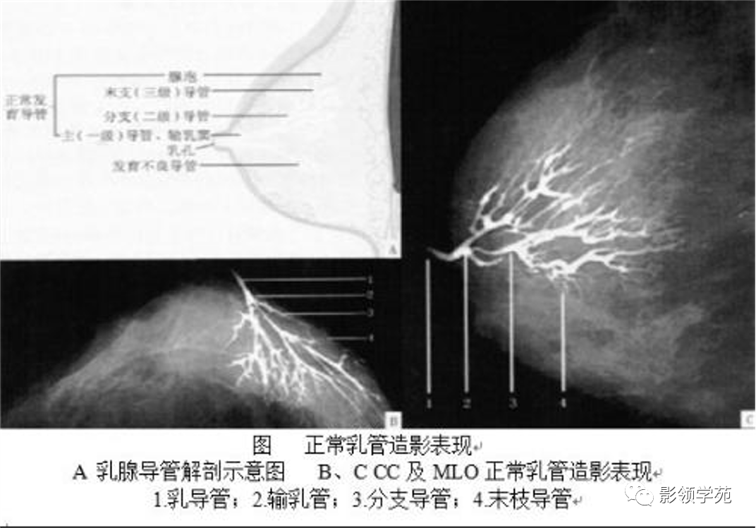 从基础到实践：乳腺常见良性肿瘤及肿瘤样变影像诊断