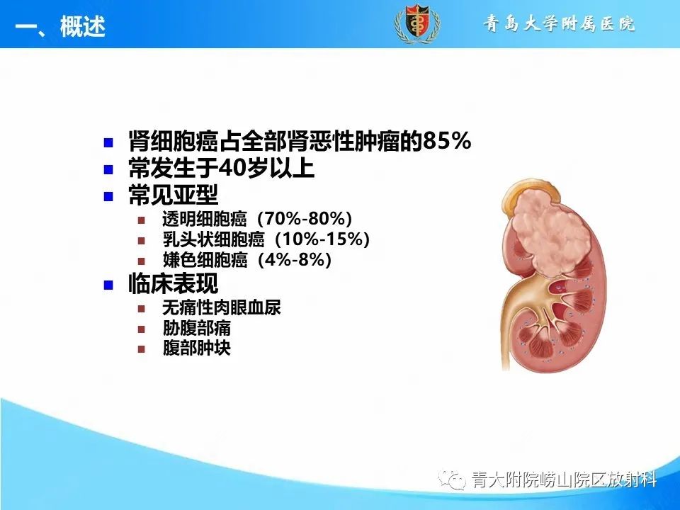 实性肾细胞癌：这些鉴别诊断很重要！