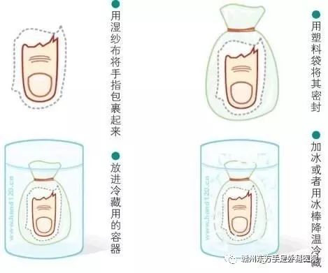 骨科常见手部外伤的诊断及治疗技巧，详细答案全解！