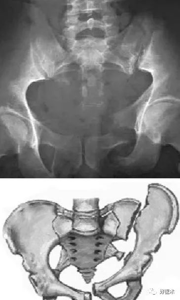 经典骨科影像片子大汇总，独立值班应急宝典！