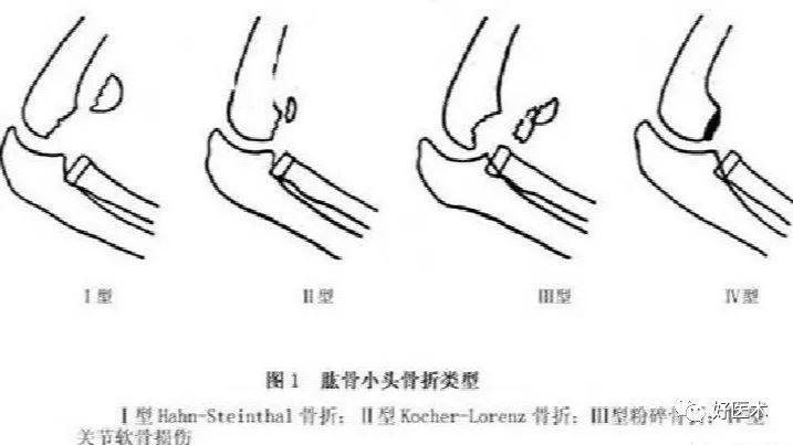 经典骨科影像片子大汇总，独立值班应急宝典！