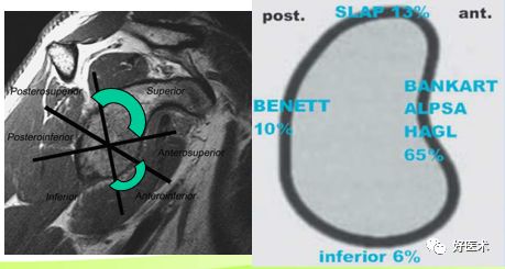 干货分享：不同的肩痛患者，这些影像学诊断技巧很实用！