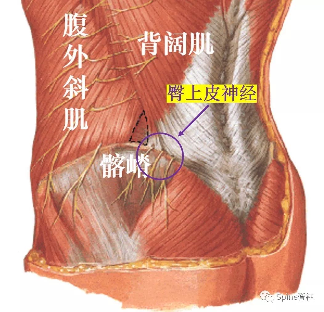 3分钟掌握：门诊容易忽略的疾病--臀上皮神经卡压综合征！