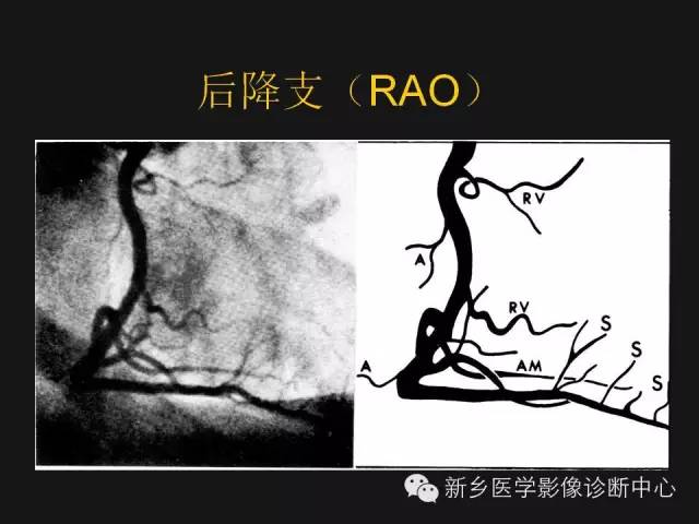 冠状动脉解剖影像，这篇讲的真齐全！