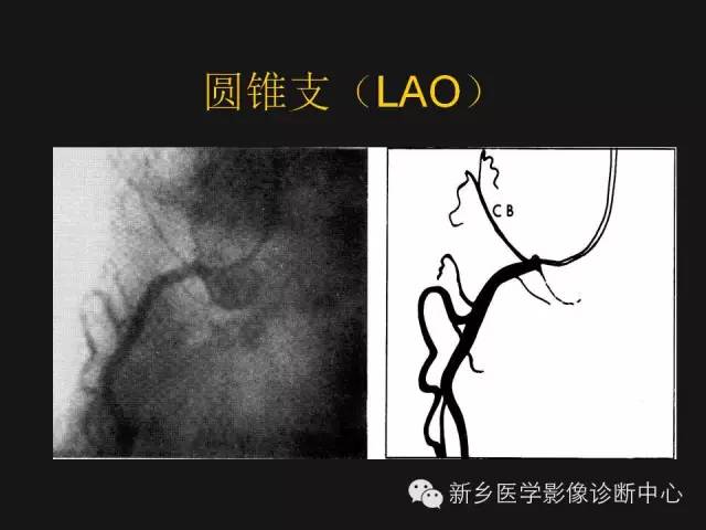 冠状动脉解剖影像，这篇讲的真齐全！