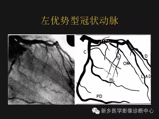 冠状动脉解剖影像，这篇讲的真齐全！