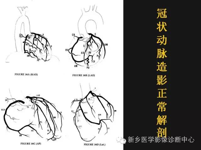 冠状动脉解剖影像，这篇讲的真齐全！