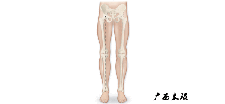 骨科必备基本功：最全下肢力线及相关角度测量，超清动图示教！