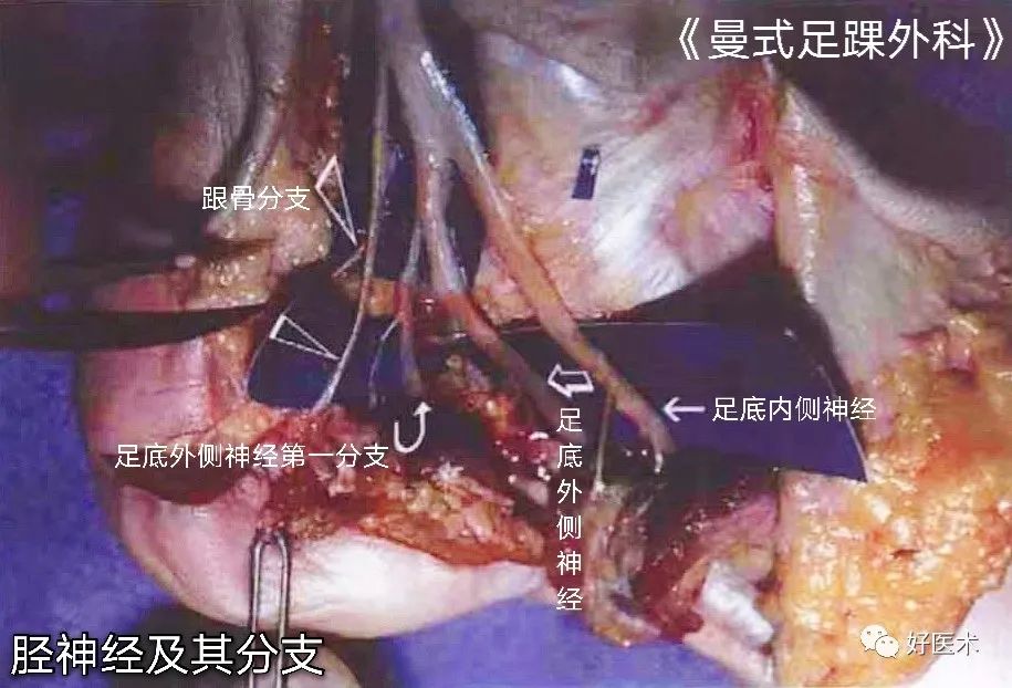 足底麻木刺痛患者，详细诊疗手册请收藏！