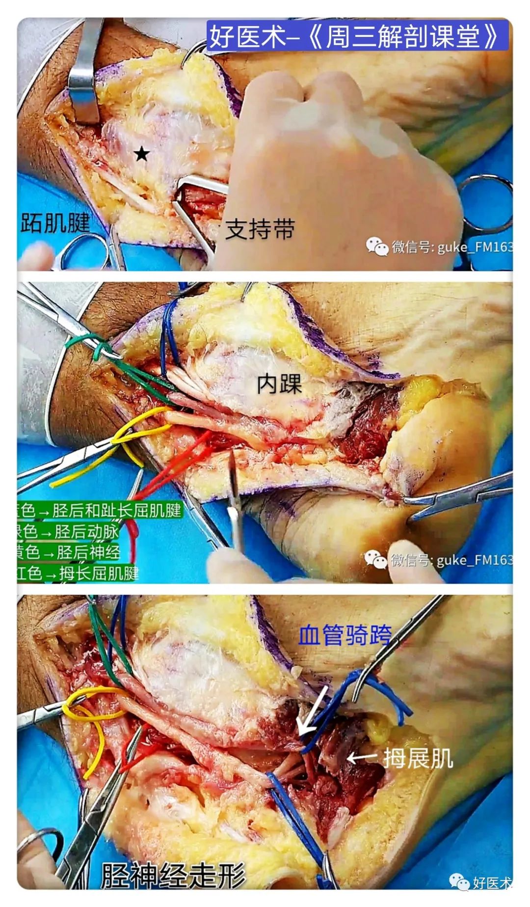 足底麻木刺痛患者，详细诊疗手册请收藏！