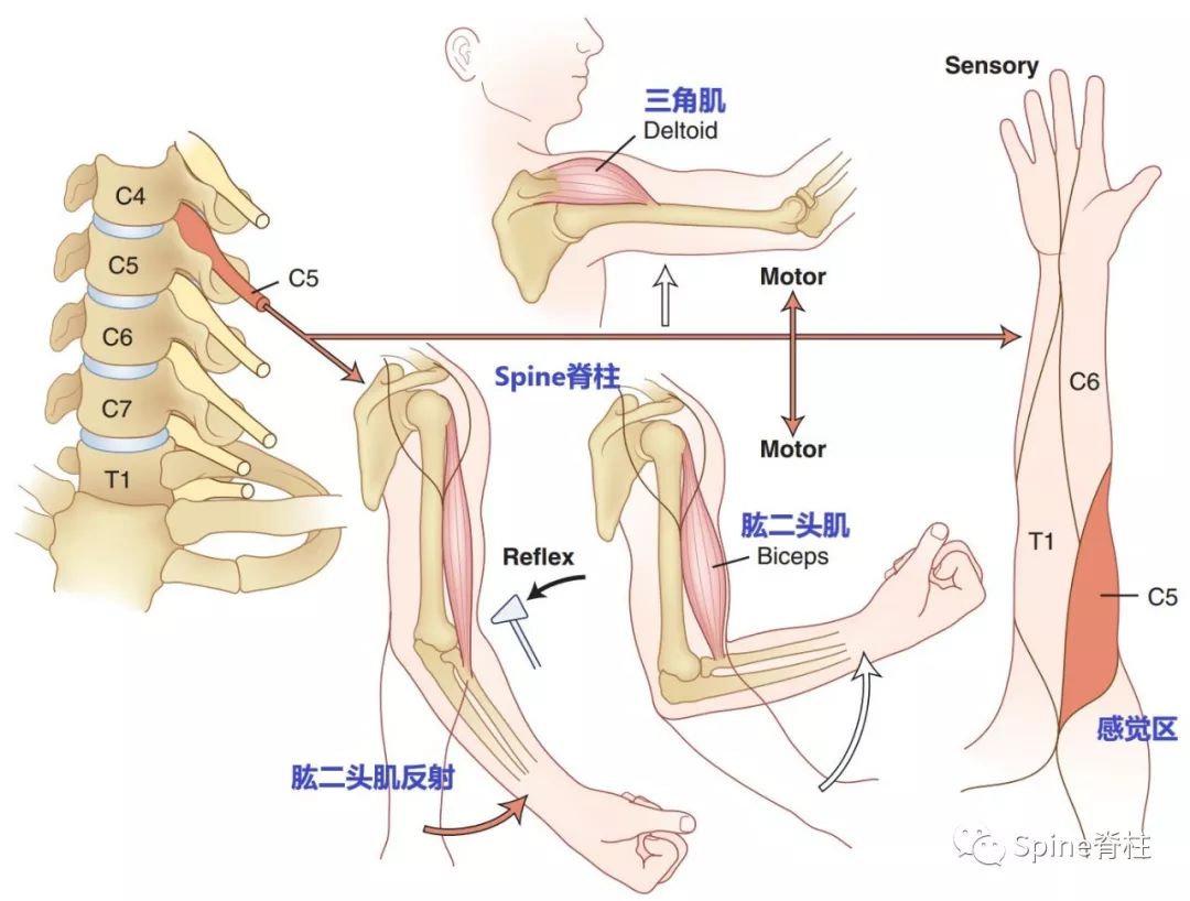 手麻、颈痛？一文读懂最常见的神经根型颈椎病！